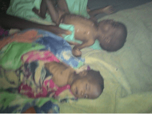 People are dying of famine in Ethiopia, Hararghe including children, mothers and adults July, August 2015 during Obama Africa visit
