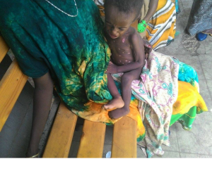 People are dying of famine in Ethiopia, Hararghe including children, mothers and adults July, August 2015 during Obama Africa visit3