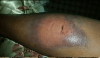 Femal Oromo singer Hawi Tezera tortured by Agazi security forces in December 2015