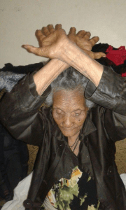 #OromoProtests December 28, 2015 Akkoon mormii irra jiru