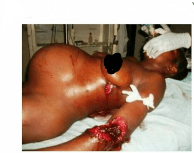 Oromo under attack, fascist Ethiopian regime military  forces  killed a 7-month pregnant and a mother six