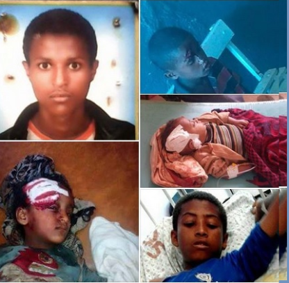 Oromo children, victims of fascist TPLF mass killings in Oromia, 2015 and 2016