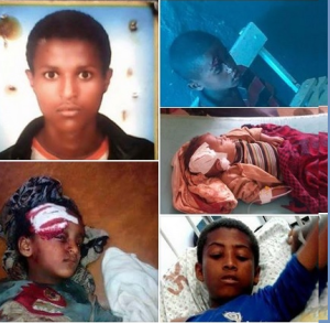 Oromo children, victims of fascist TPLF mass killings in Oromia, 2015 and 2016