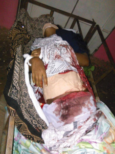 Body of Sabrina Abdalla, the 10th grade Oromo student who was gunned down in the night of 20 June 2016 byfascist Ethiopia's regime soldiers in Chalanqo, East Hararge.