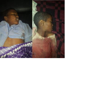 Fascist Ethiopia's regime forces killed several Oromo children in Awaday, Oromia, 1 July 2016