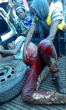 #OromoProtests, Awaday, Oromia 31 July 2016. Fascist Ethiopia's regime forces killed 6 people and injured 26.
