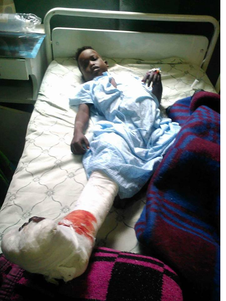 This Oromo  child is Lencho Abdi Abdulkarim, one of the 6 people shot in Dogu town, Gurawa District, East Hararge when fascist Ethiopia's regime forces  opened fire on wedding party on July 25, 2016