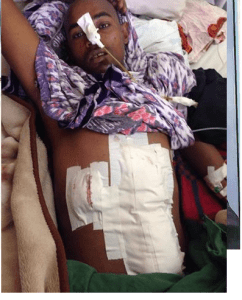 Zubeyr Kadir gunned down by Ethiopia's regime fascist forces on 6 August 2016 in Robe Bale, Oromia