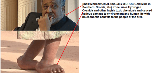 Sheik Mohammed Al Amoudi and MIDROC Gold Mine in Southern Oromia, Guji zone, uses Hydrogen Cyanide and other highly toxic chemicals and caused serious damage to environment and human